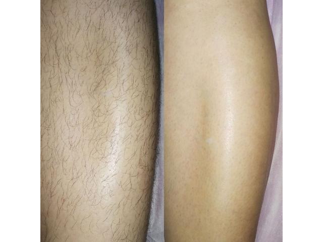 Алба Юлия 1. Шугаринг. Сахарная депиляция Буюканы.