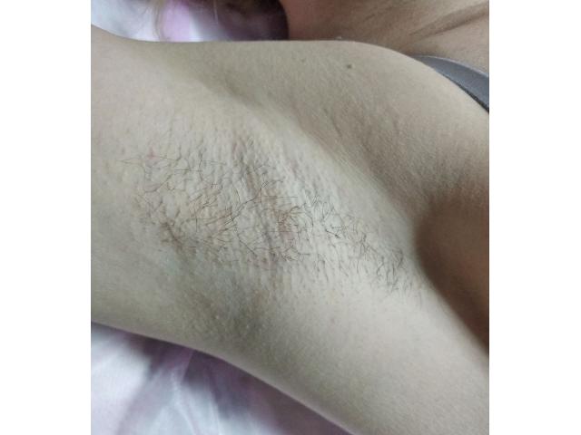 Алба Юлия 1. Шугаринг. Сахарная депиляция Буюканы.