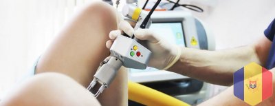Condiloame genitale: îndepărtarea laser a verucilor genitali si condiloamelor  in Moldova ( Chisinau