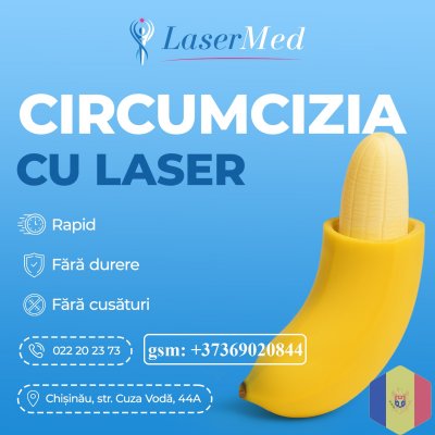 Frenotomia, Frenoplastia laser in Moldova (Chisinau)!LasermedMoldova