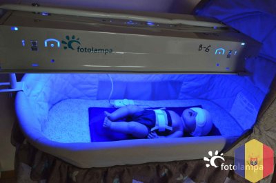 лечение детской желтухи на дому. аренда медицинской лампы при ( желтушке ) желтухе у малышей. терапи