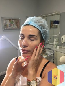 Чистка лица атравматичная с пилингом