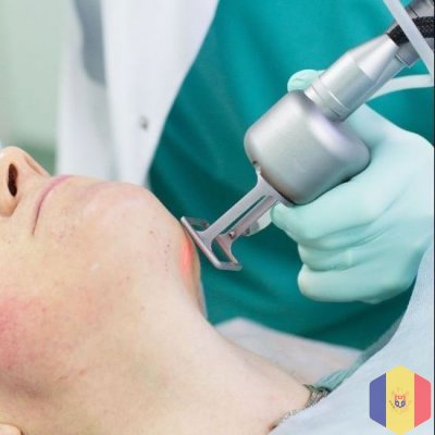 Лазерное удаление шрамов и рубцов (Лазерная коррекция дефектов кожи (рубцов/шрамов)) в Кишиневе, Мо