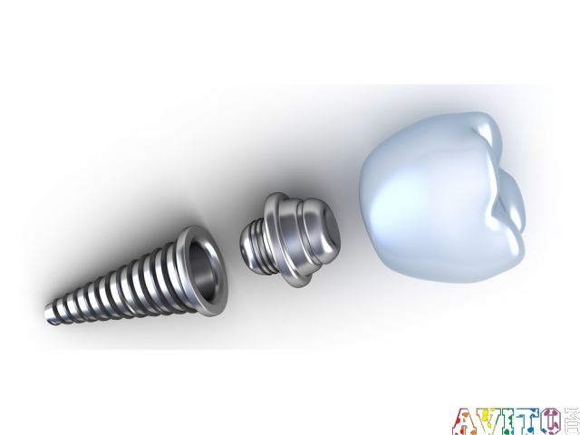 Надежно восстанавливаем зубы для счастливой улыбки